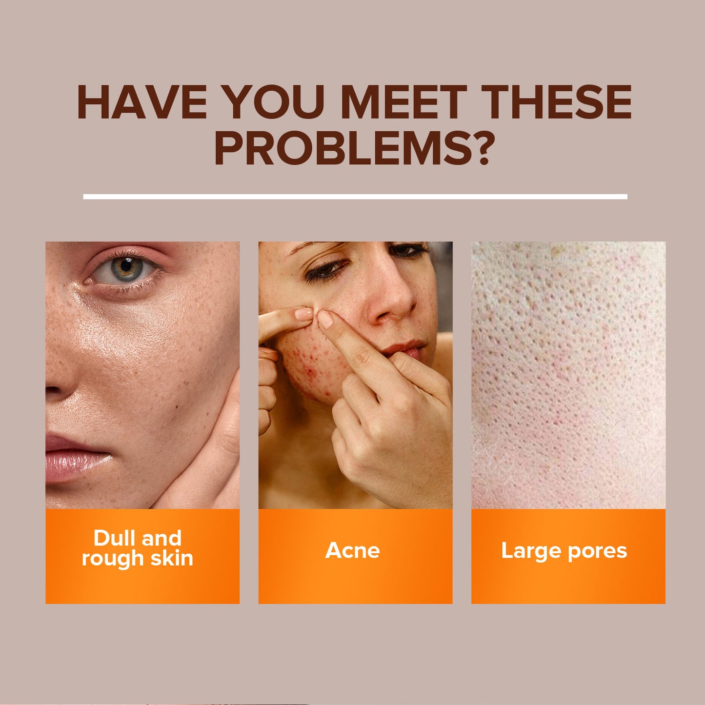 Custom Private Label 100g Anti-acne Shrinking Pores Improving Skin Dull Turmeric Ginger Face Body Soap