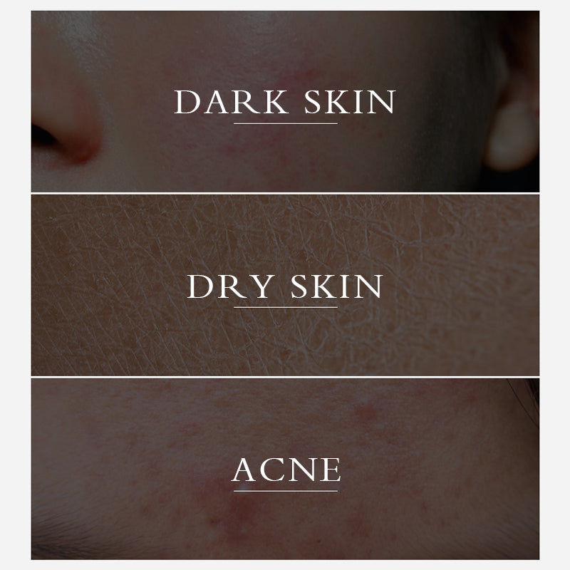 50g Customization Acceptable Acne Removal Improving Skin Dull Brightening Moisturizing Turmeric Facial Cream