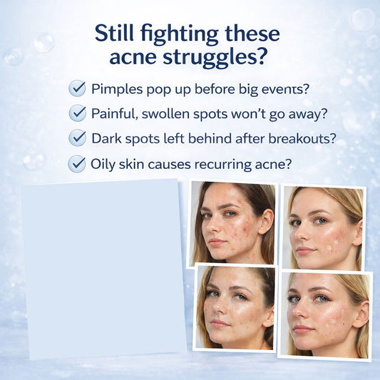 OEM 15ML Salicylic Acid Sulfur Niacinamide 24H Spot Rescue Acne Lotion