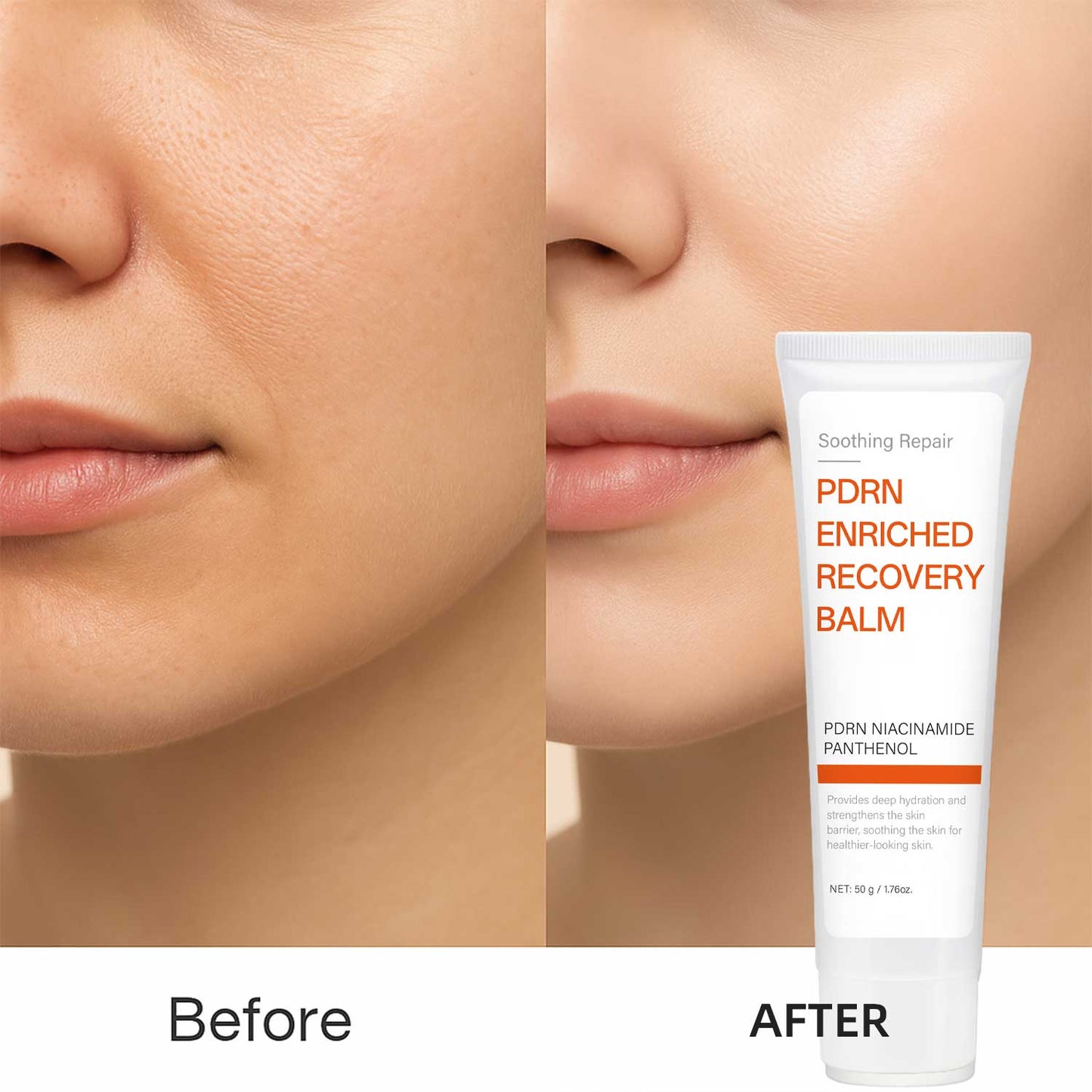 Custom Brand 50g Repairing Brightening PDRN Enriched Recovery Balm