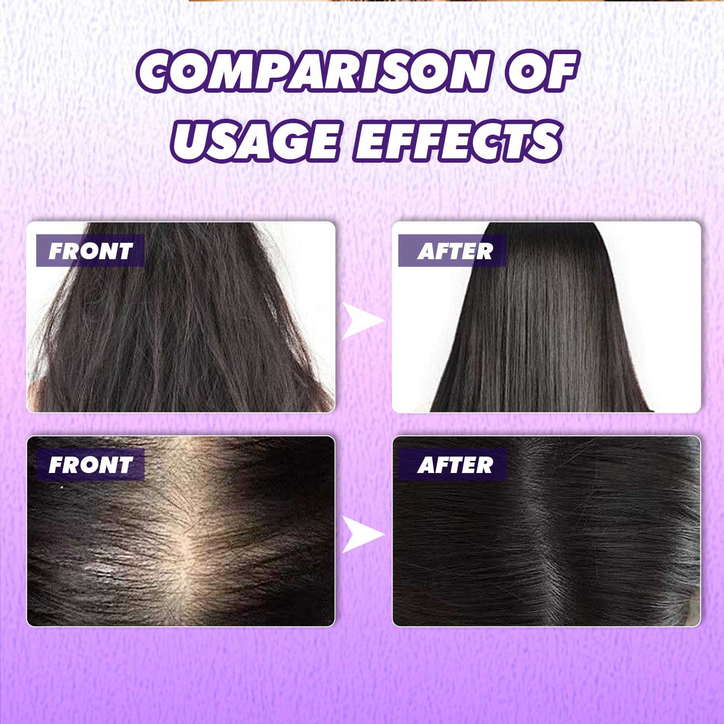 Custom Logo Wholesale 60ML Revitalize Strengthen Smooth Shiny Black Rice Hair Growth Spray