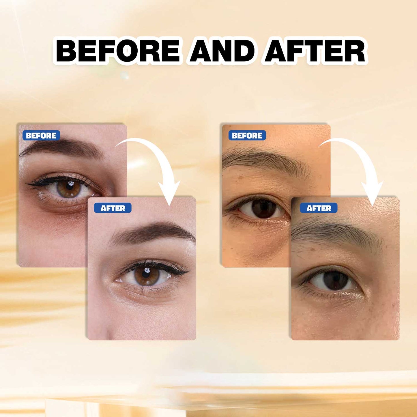 OEM ODM Wholesale 24 Pairs in One Box Anti-aging Anti-wrinkle Dark Circle Removal Firming Lifting Eye Patches