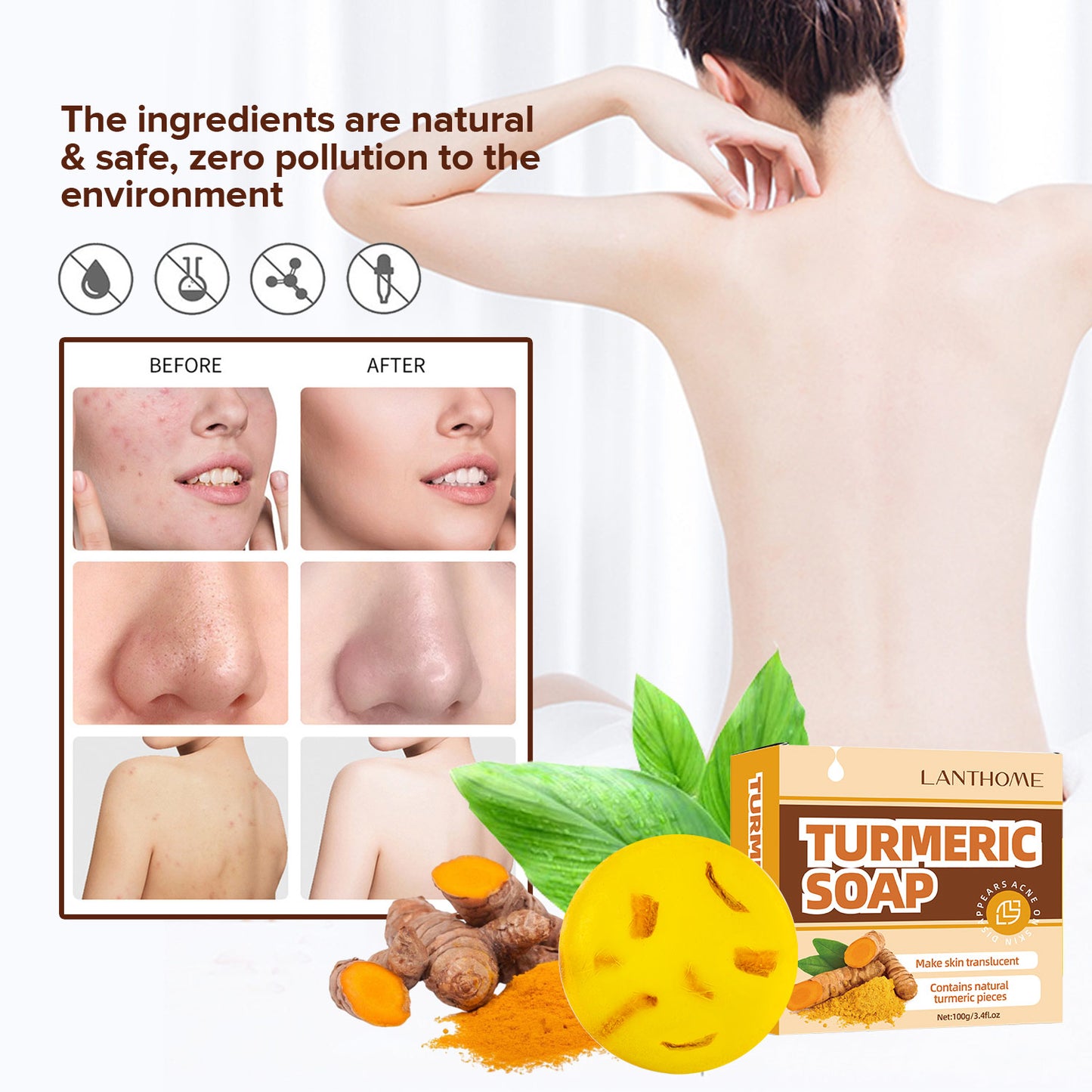 Custom Private Label 100g Anti-acne Shrinking Pores Improving Skin Dull Turmeric Ginger Face Body Soap