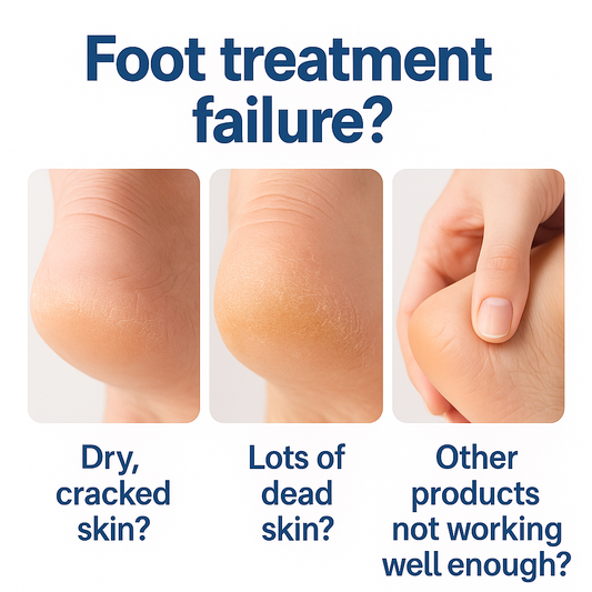 OEM ODM 40g Exfoliating Cracked Heel Treatment Foot Care Cream Stick