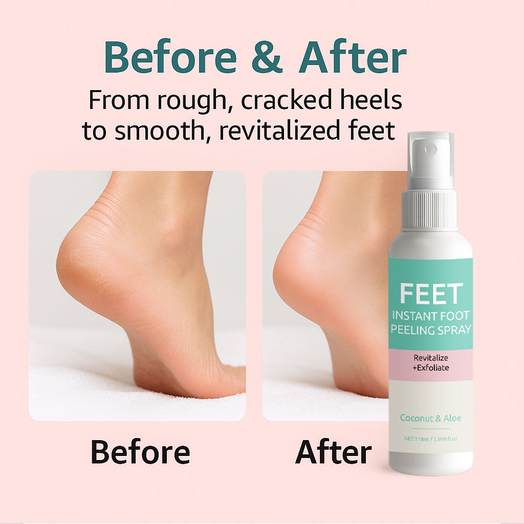 OEM ODM 118ML Soften Tender Lightening Instant Foot Peeling Spray