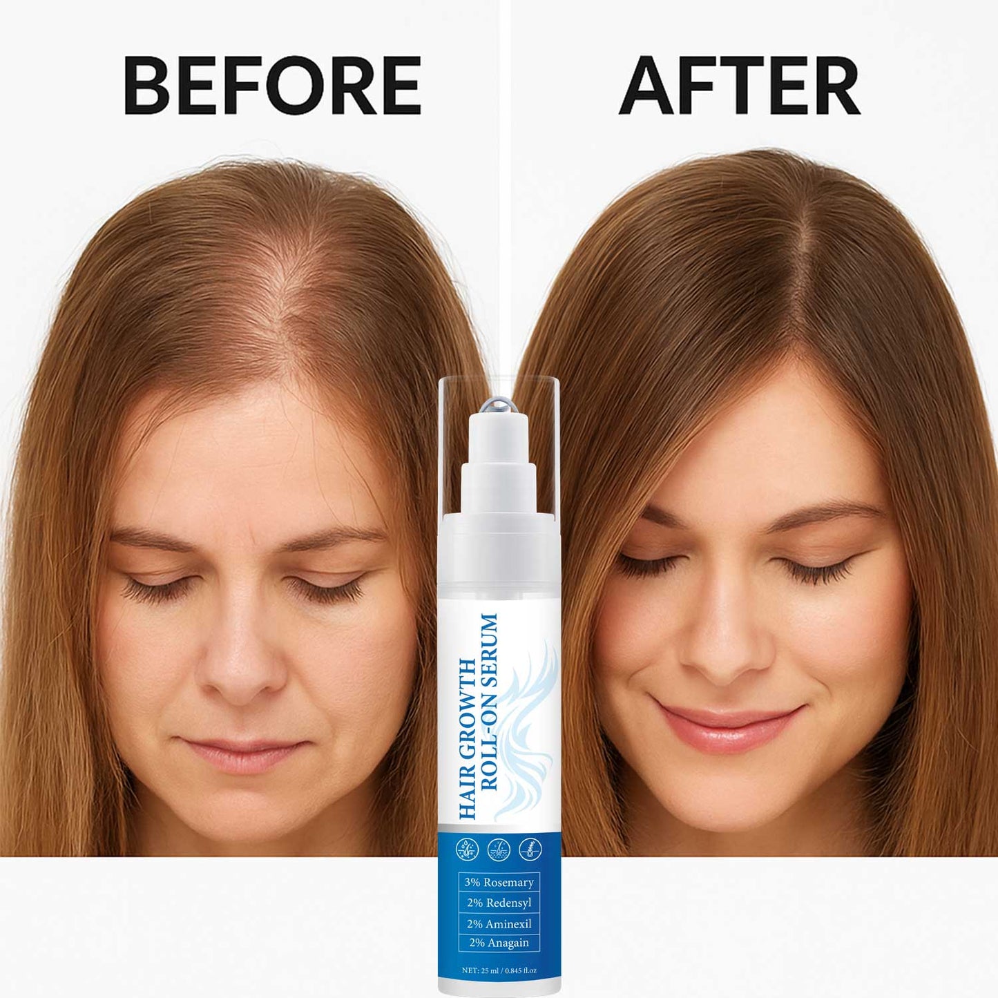 Private Label 25ML Volume Strengthen Hair Growth Roll-On Serum