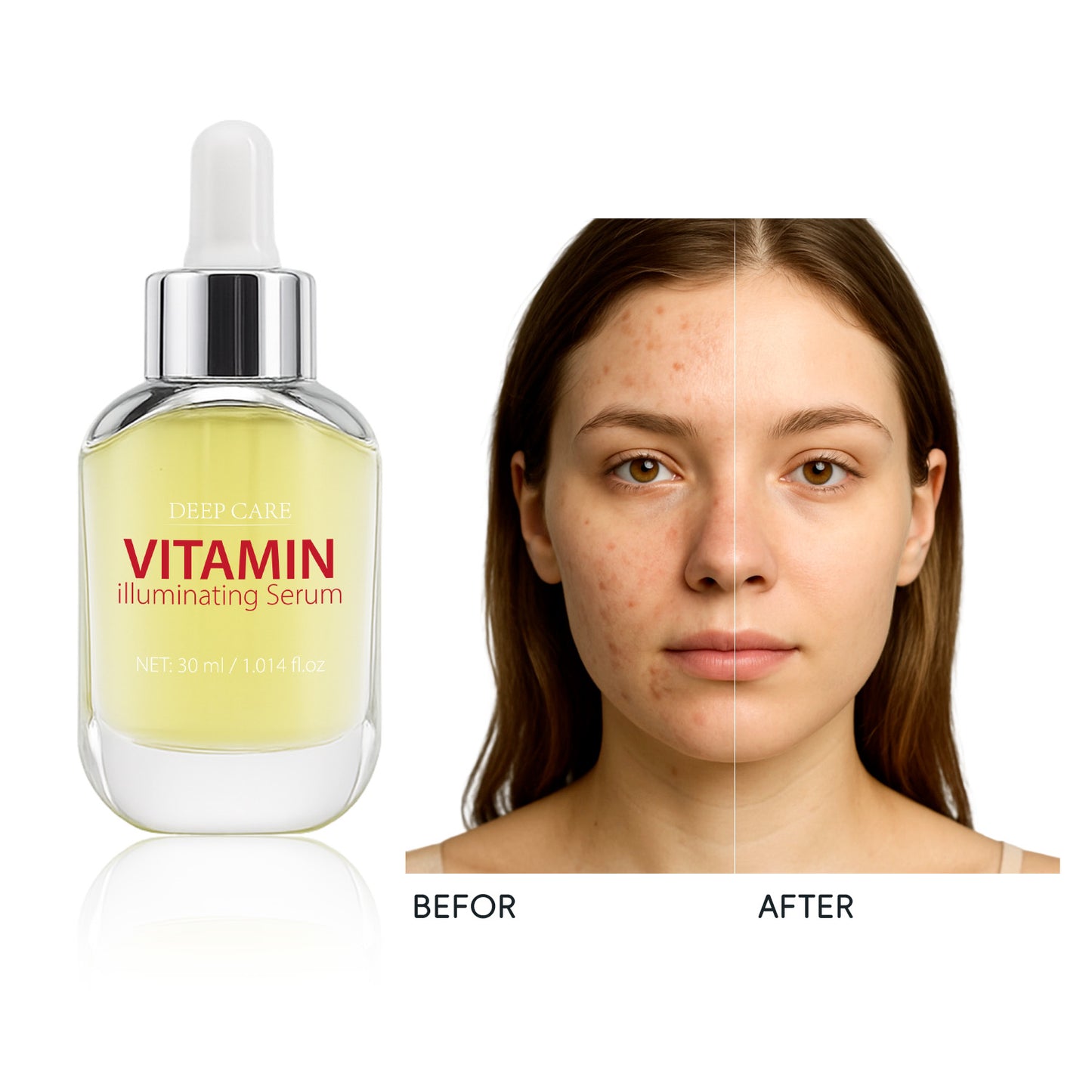OEM ODM 30ML Dark Spots Removal Brightening Vitamin C Serum